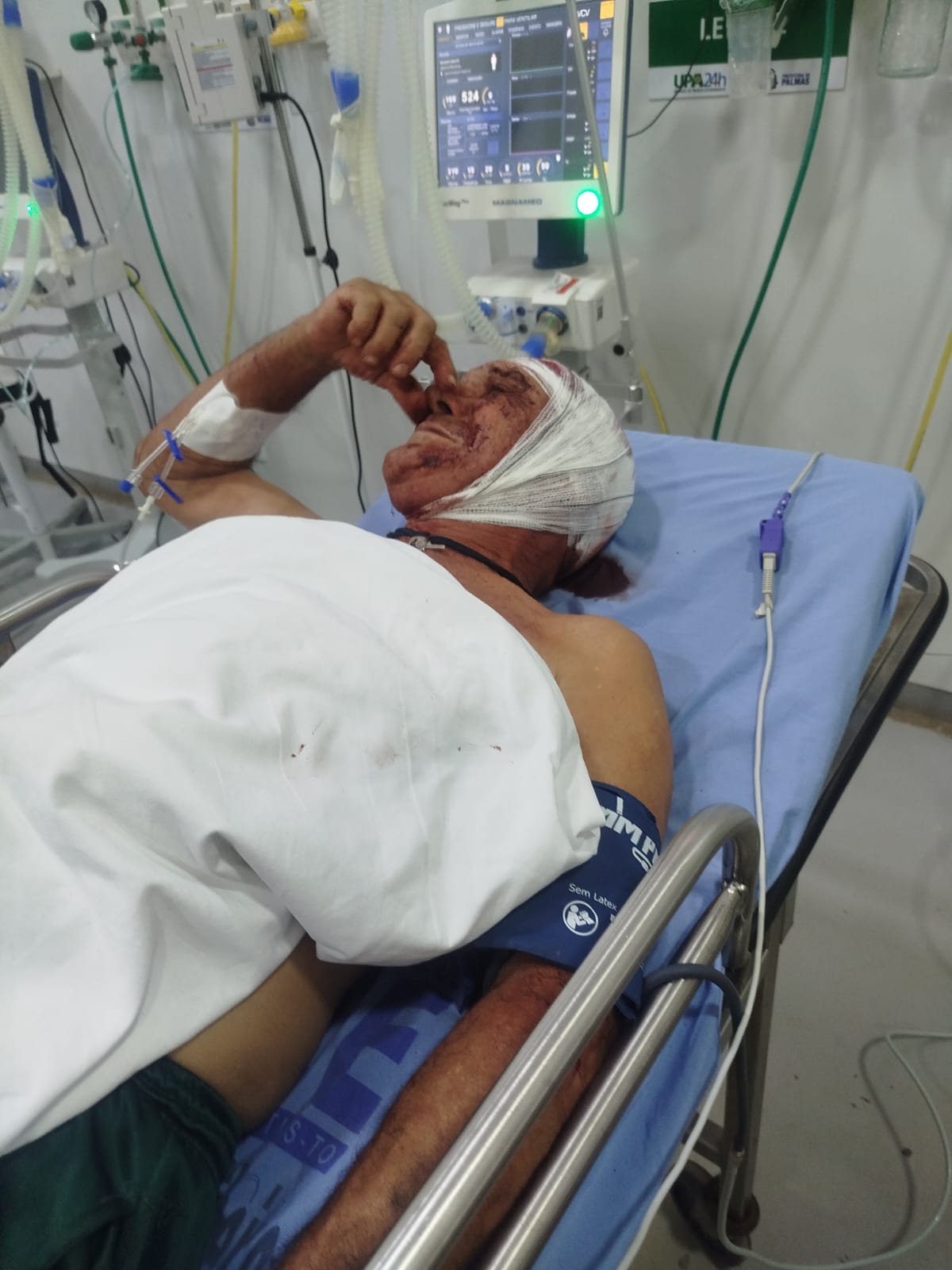 Vítima foi encontrada na Estação Javaé com ferimentos na cabeça. 